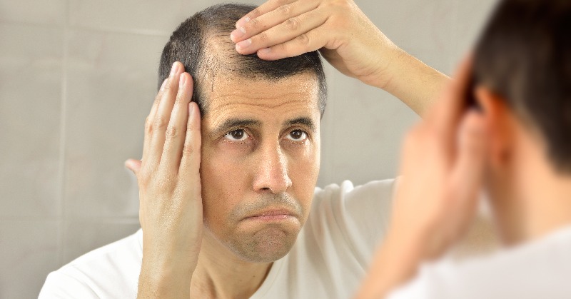 The Ultimate Guide to Advanced Hair Regrowth Treatments with best hair fall treatments in surat