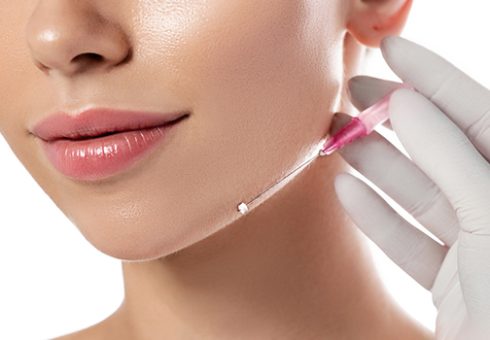 Thread Lift Treatment